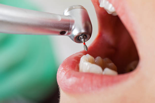 Best Emergency Dental Surgery in Minier, IL